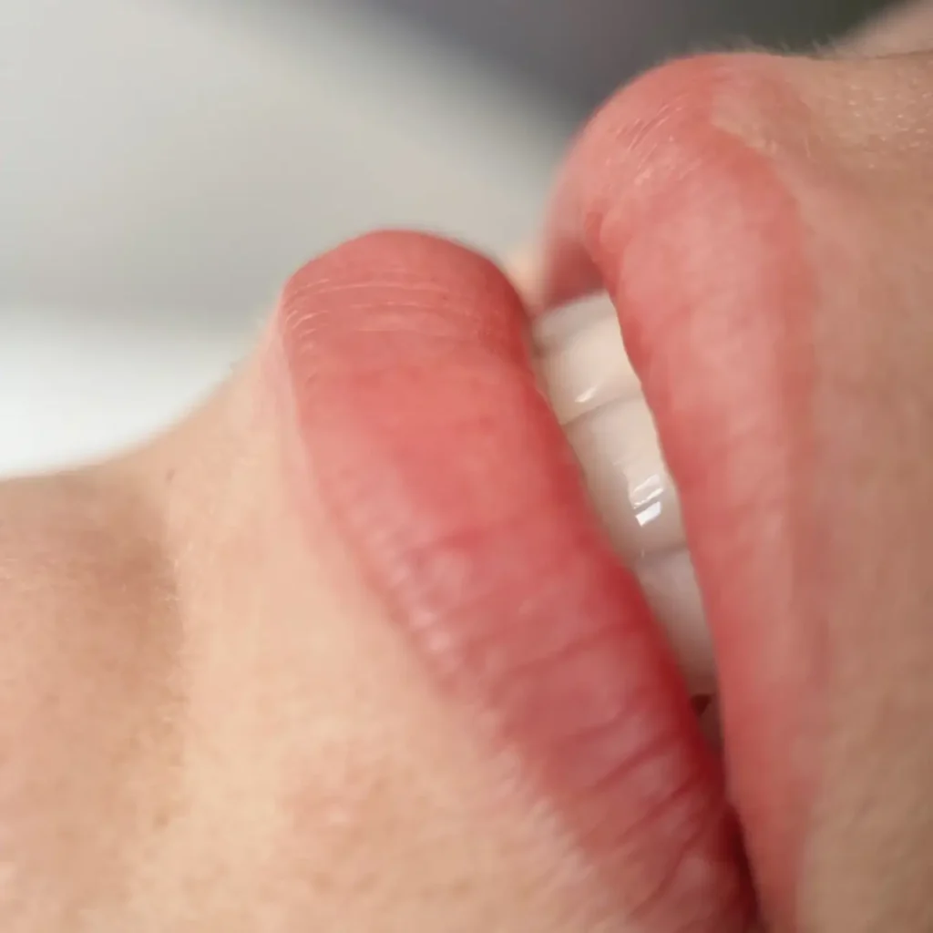 ajaktetoválás herpesz nélkül